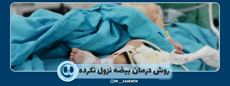 روش درمان بیضه نزول نکرده
