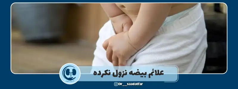 علائم بیضه نزول نکرده