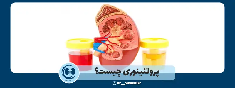 پروتئینوری چیست؟