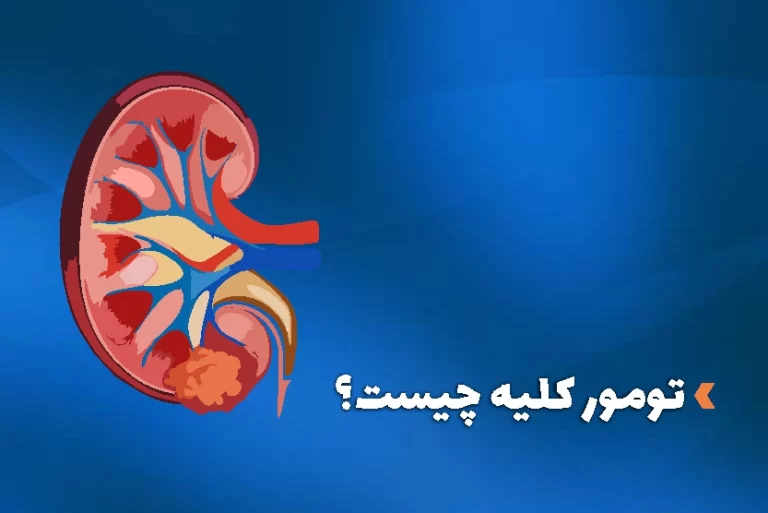 تومور کلیه چیست؟