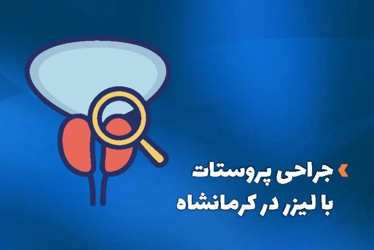 جراحی پروستات با لیزر در کرمانشاه