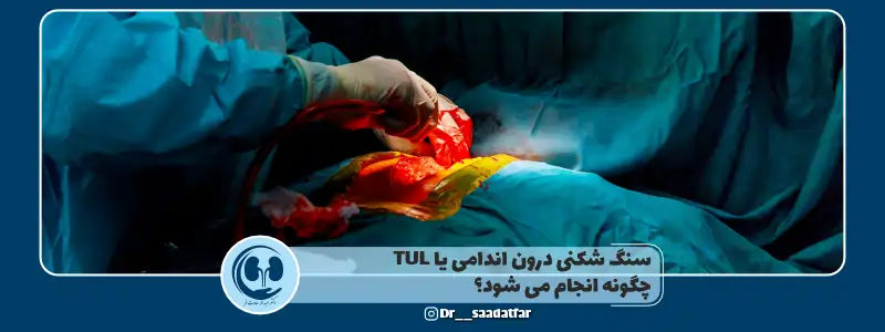 سنگ شکنس درون اندامی چگونه انجام می شود
