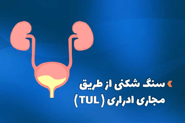سنگ شکنی از طریق مجرای ادراری یا عمل TUL چیست
