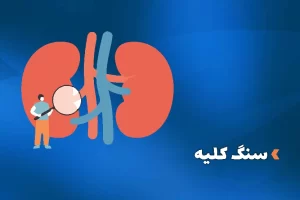 بررسی سنگ کلیه