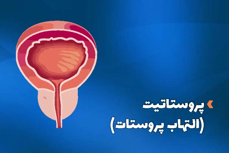 التهاب پروستات یا پروستاتیت چیست؟