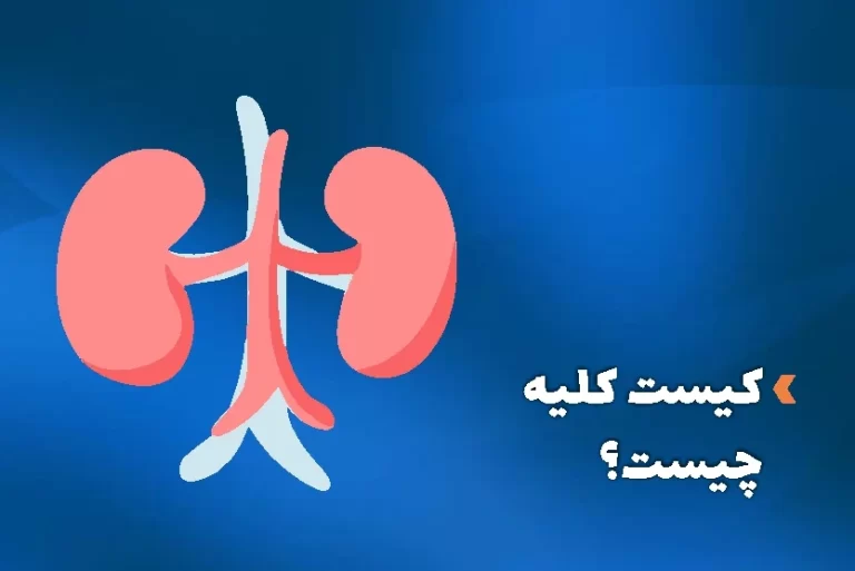 کیست کلیه چیست؟ علل، علائم و درمان