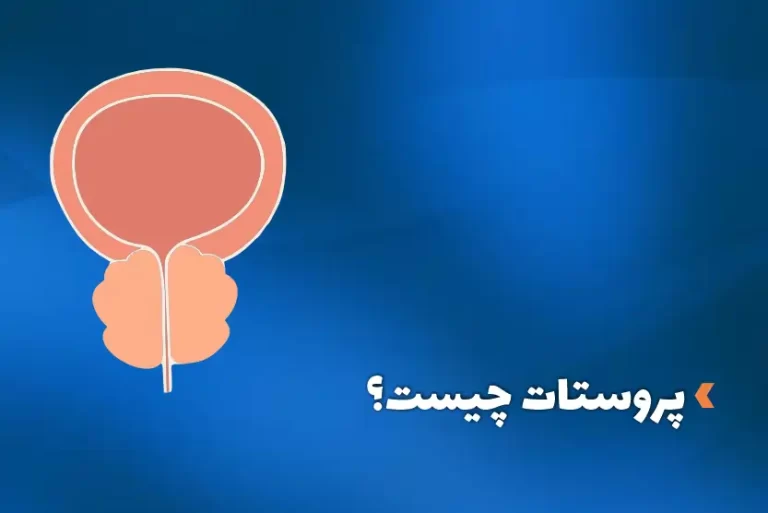 پروستات چیست