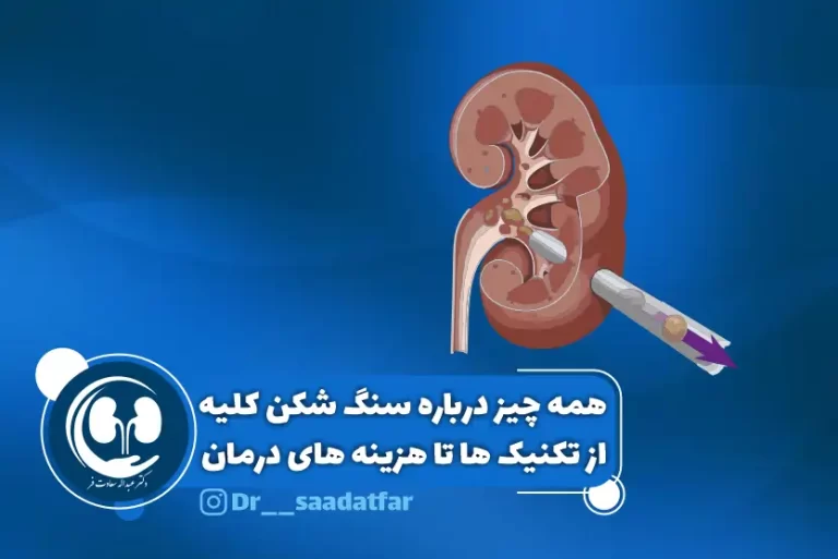همه چیز درباره سنگ شکن کلیه از تکنیک ها تا هزینه های درمان