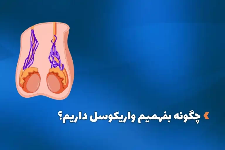 چگونه بفهمیم واریکوسل داریم؟