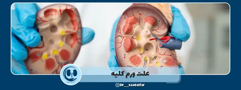 علت ورم کلیه