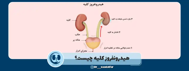 هیدرونفروز کلیه چیست؟