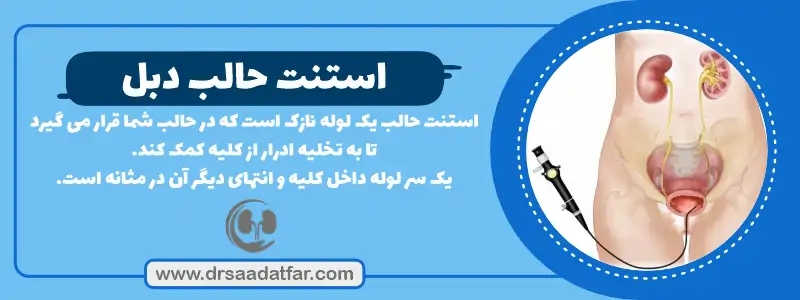 استنت حالب چیست؟