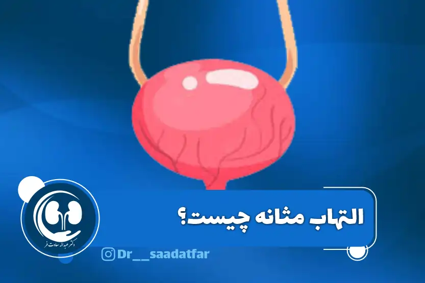 التهاب مثانه چیست؟