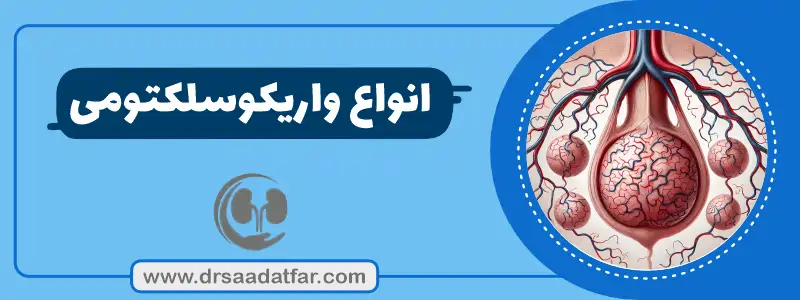 انواع عمل واریکوسل