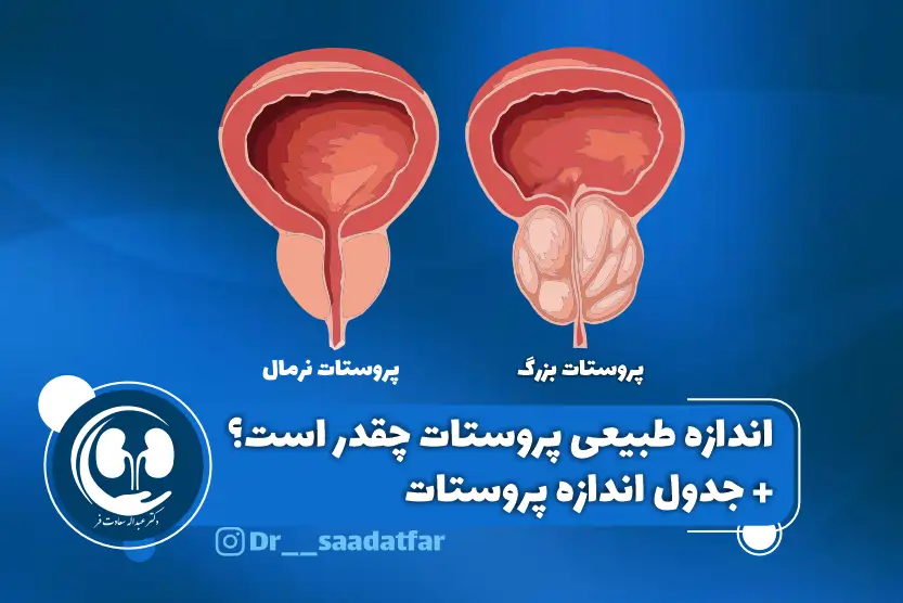 اندازه پروستات چقدر است + جدول اندازه پروستات