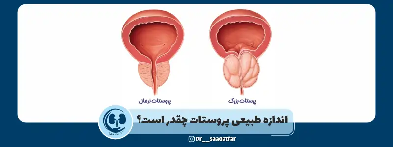 اندازه طبیعی پروستات چقدر است