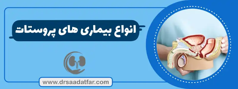 انواع بیماری های پروستات