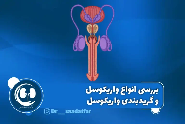 بررسی انواع واریکوسل و گریدبندی واریکوسل