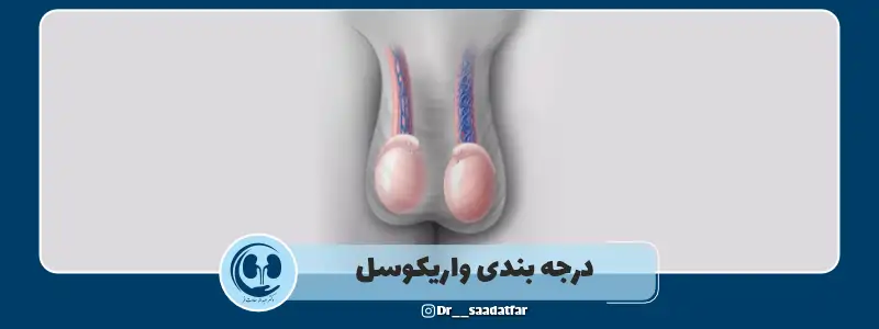 درجه بندی واریکوسل