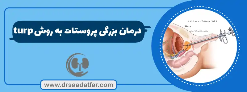 درمان بزرگی پروستات با TURP