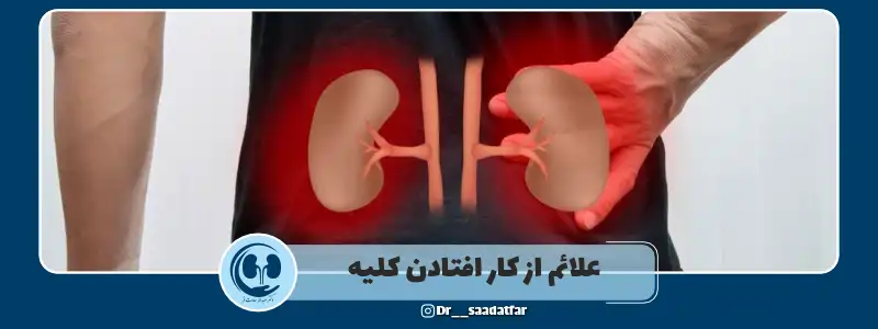 علائم از کار افتادن کلیه