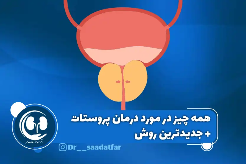 همه چیز در مورد درمان پروستات