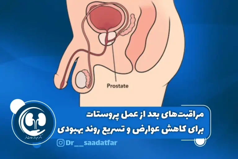 مراقبت بعد از عمل پروستات