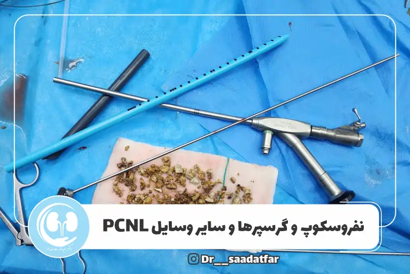 جراحی سنگ کلیه در کرمانشاه