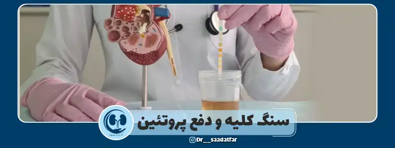 سنگ کلیه و دفع پروتئین