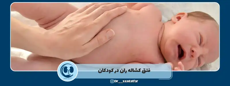 فتق کشاله ران در کودکان
