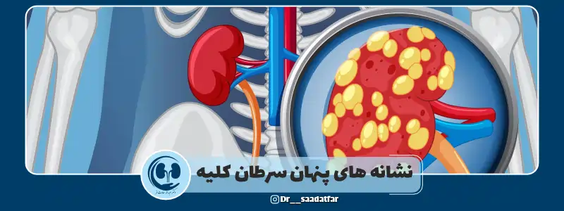 نشانه های پنهان سرطان کلیه