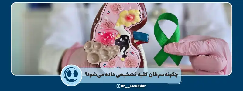 چگونه سرطان کلیه تشخیص داده می‌شود؟