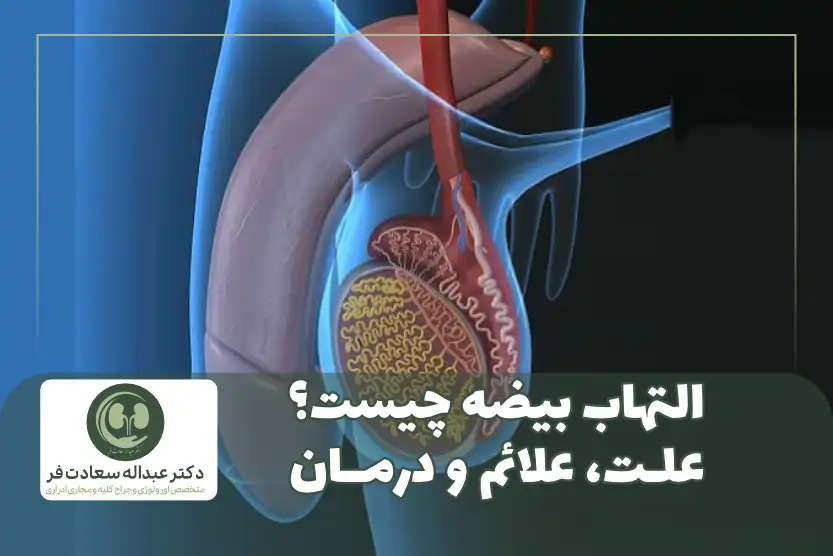 التهاب بیضه چیست؟ علت، علائم و درمان