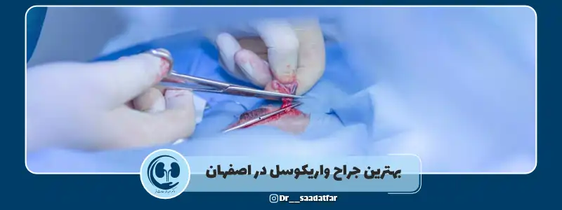 بهترین جراح واریکوسل در اصفهان