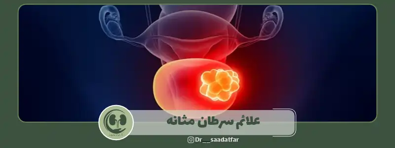 علائم سرطان مثانه