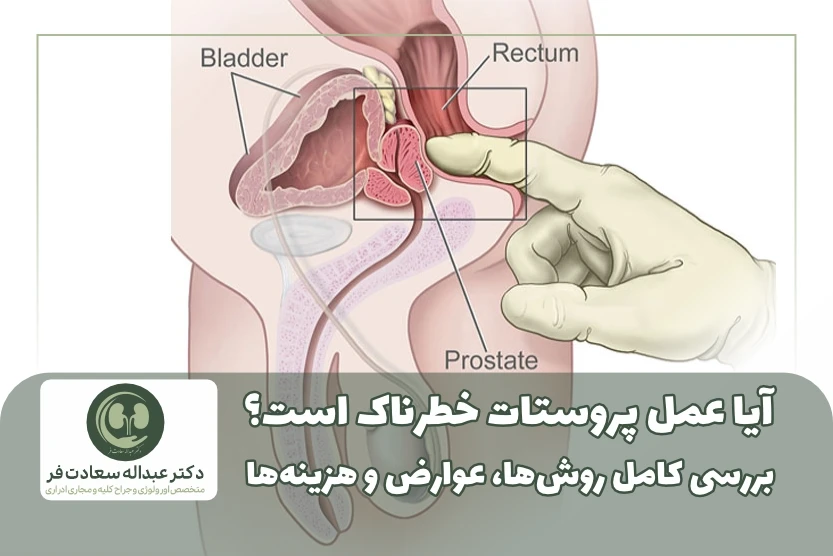 آیا عمل پروستات خطرناک است؟ بررسی کامل روشها، عوارض و هزینهها