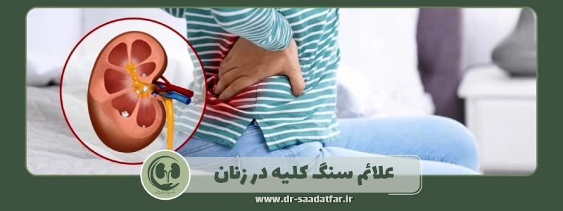 علائم سنگ کلیه در زنان