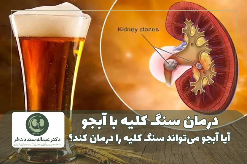 درمان سنگ کلیه با آبجو آیا آبجو میتواند سنگ کلیه را درمان کند؟