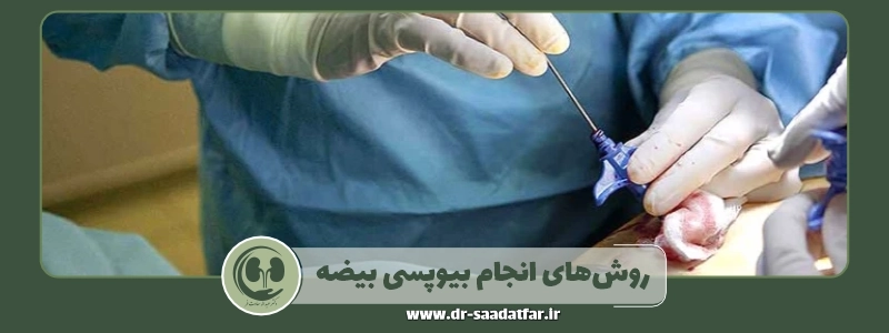 روش_های انجام بیوپسی بیضه