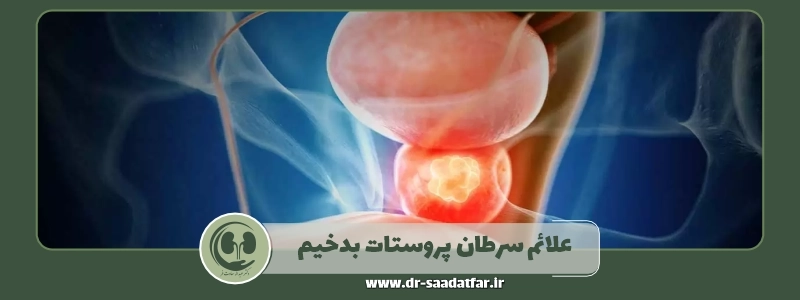 علائم سرطان پروستات بدخیم