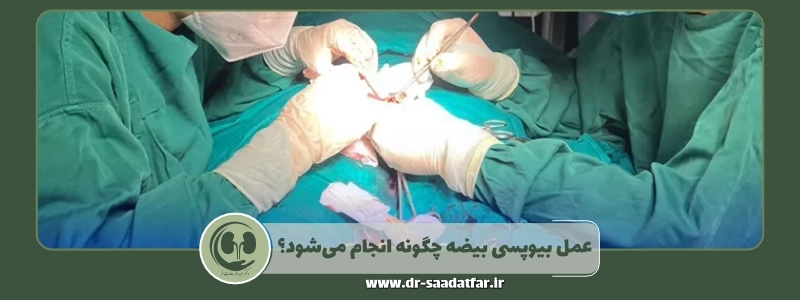 عمل بیوپسی بیضه چگونه انجام می_شود؟