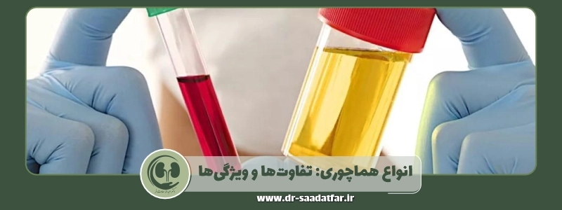 انواع هماچوری تفاوت_ها و ویژگی_ها