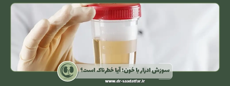 سوزش ادرار با خون آیا خطرناک است؟