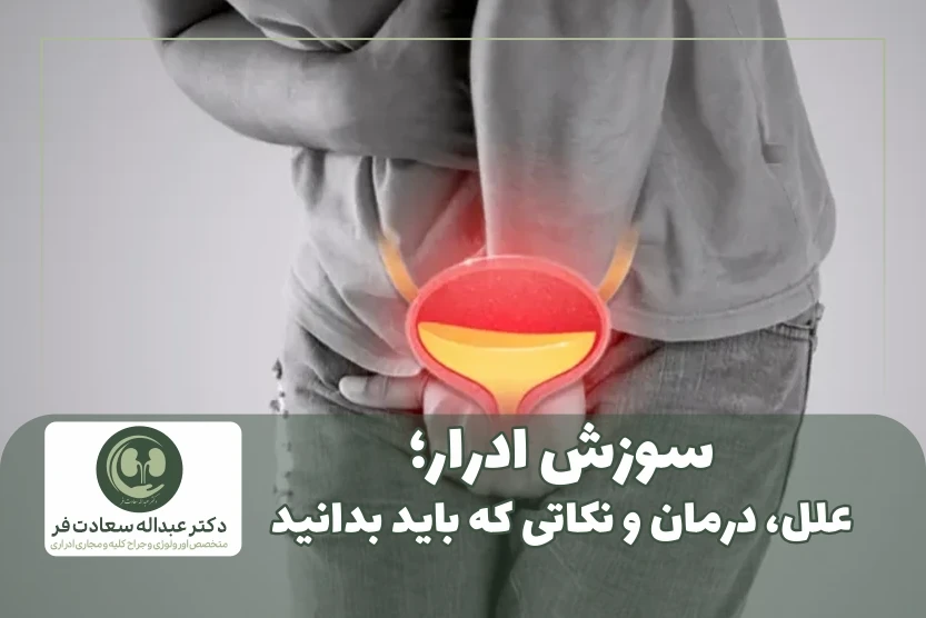 سوزش ادرار علل، درمان و نکاتی که باید بدانید