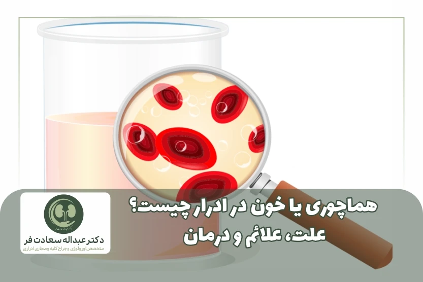 هماچوری یا خون در ادرار چیست؟ علت، علائم و درمان