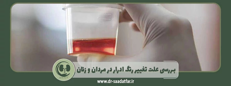 بررسی علت تغییر رنگ ادرار در مردان و زنان