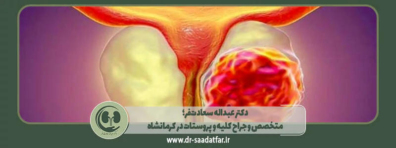 دکتر عبداله سعادت فر؛ متخصص و جراح کلیه و پروستات در کرمانشاه