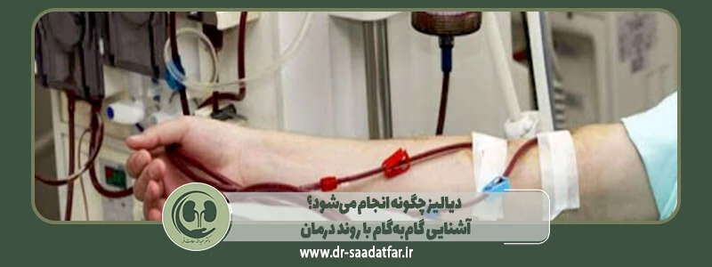دیالیز چگونه انجام میشود؟ آشنایی گامبهگام با روند درمان