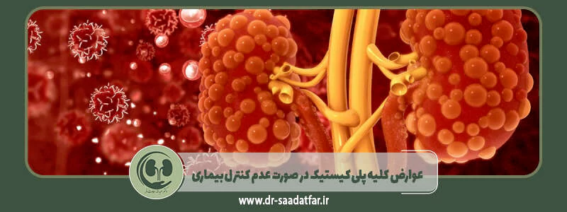 عوارض کلیه پلی کیستیک در صورت عدم کنترل بیماری