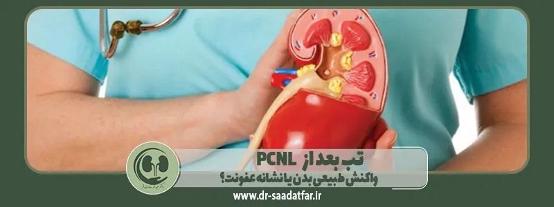 تب بعد از PCNL: واکنش طبیعی بدن یا نشانه عفونت؟